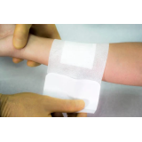 EUROMED MEDICAZIONE POST-OP CM10X20 X50