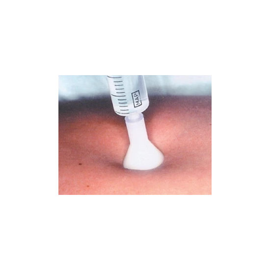 AGO MESOTERAPIA G31 2,5MM 25PZ